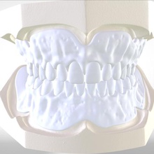 digital try-in full dentures injection molding various dental lab medical teeth cult3d 3shape cam obj stl keyshot 3d printer cad 3d print model - Mito3D