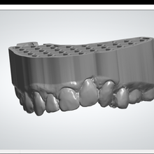 endodontique palais modèle 3d print model - Mito3D