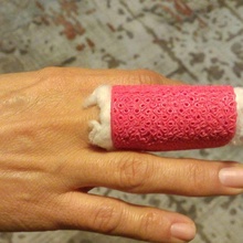 finger splints 3d print model - Mito3D