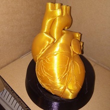 cuore d'oro art la scansione ct arteria aorta le valvole l'anatomia 3d print model - Mito3D