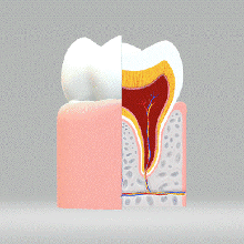 gum architecture medicine 3d print model - Mito3D