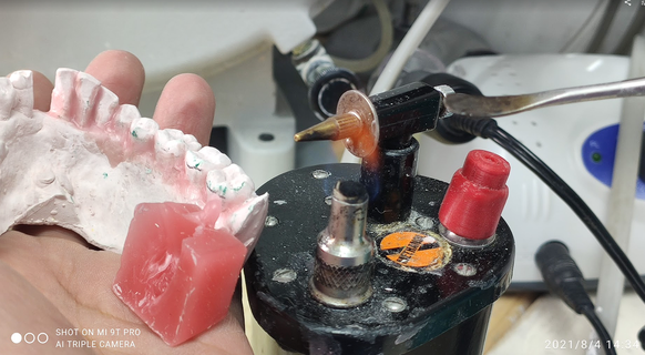 onlara çakmak şapka diş diş protez onlara çakmak onlara çakmak diş hekimliği diş doktoru 3d print model - Mito3D