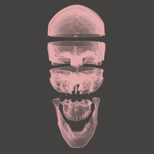 hd anatómica del cráneo 5 partes art facial de la cara bóveda craneal mandibula en el maxilar superior femenino cabeza tomografía computarizada anatomía 3D print model - Mito3D