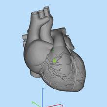 Herz verschiedene 3d print model - Mito3D