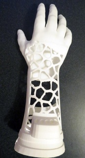 çobanpüskülü kol v2 antromod protez Robohand 3d print model - Mito3D