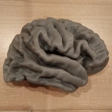humano cérebro modelo anatomia Ciência mri 3d print model - Mito3D