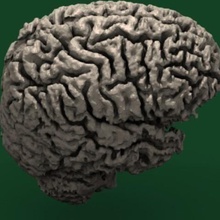 o cérebro humano vários ressonância magnética modelo blender 3d 3d print model - Mito3D
