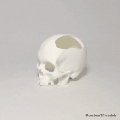 humano cranioplastia crânio invesalius medicamento acidente defeito implantar 3d print model - Mito3D