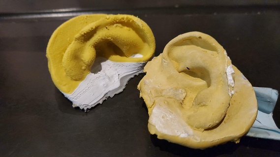 humano orelha 1 prótese maxilofacial 3d Varredura médico modelo real paciente 3d print model - Mito3D