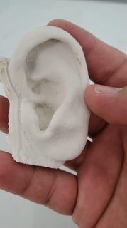 human ear 2 prosthesis maxilofacial 3d scan medical model real patient 3d print model - Mito3D
