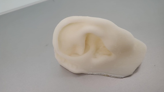 human ear 3 prosthesis maxilofacial 3d scan medical model real patient 3d print model - Mito3D