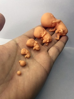 human embryo biomodels embryos fetuses anatomy fetal embryology 3d print model - Mito3D