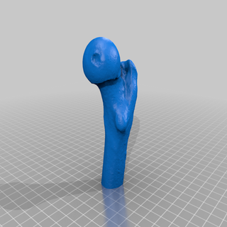 human femur learning 3d print model - Mito3D