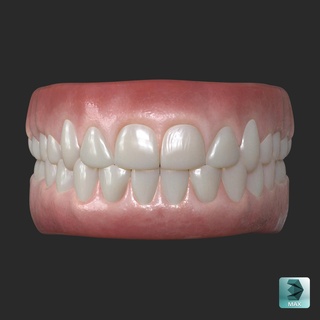 umano gomma denti 3d print model - Mito3D
