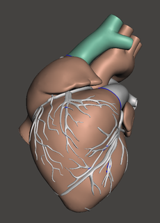 humano corazón anatomía 3dprint impresión corazon medico médico 3d print model - Mito3D