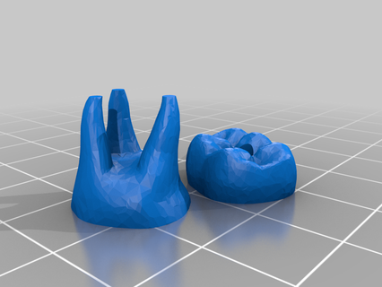 humano dente cordão cápsulas moda 3d print model - Mito3D
