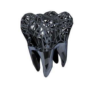 joalheria dente coroa acessório rede odontologia miniatura 3d print model - Mito3D