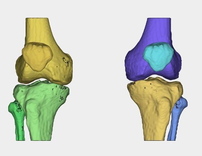 knee joint anatomy medical 3d printing human limbs bone 3d print model - Mito3D