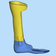 leg orthosis brace 3d print model - Mito3D