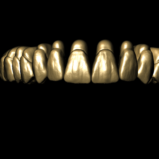 libreria dentale adaptada para meshmixer vari anatomia stl dientes 3d st perez giugovaz 3D print model - Mito3D