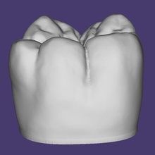 macromodelo molar 46 dentes 3d print model - Mito3D