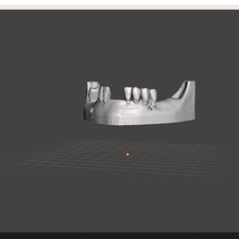 mandible removable teeth gadget tooth 3d print model - Mito3D