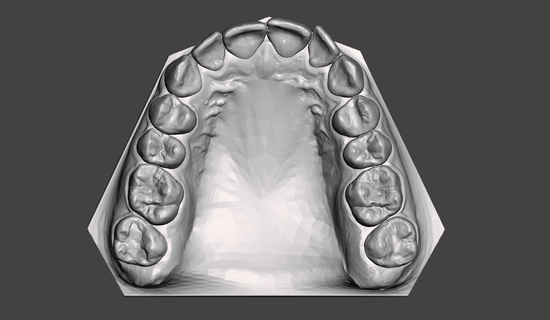 maxilla arch teeth tooth dental model medical 3d print model - Mito3D