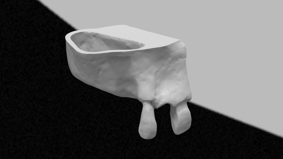 maxilar seno modelo dental odontología dientes diente práctica restaurativo 3d print model - Mito3D