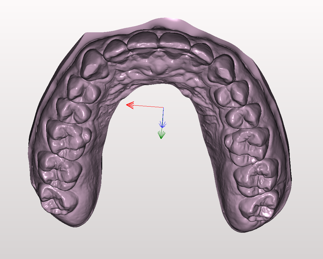 maxillary teeth 3D print model - Mito3D