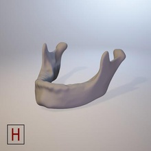 tıbbi tasarım mandibula çeşitli insan anatomi 3d print model - Mito3D