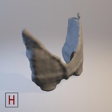 medical design thyroid various human anatomy 3d print model - Mito3D