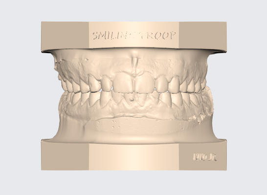 modelo dental superior inferior articulado 9 protésico t cnico diente 3d stl dentista gratis ortodoncia impresi n 3d print model - Mito3D