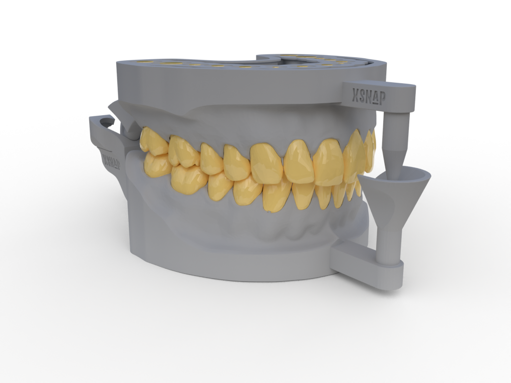 modèles amovible dents 3D print model - Mito3D