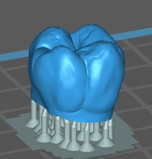 molar 46 anatômico anatomia 3d print model - Mito3D