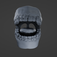 mouth braces 3d print model - Mito3D