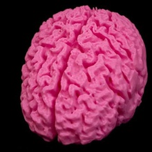 mrı beyin tarama çeşitli 3d print model - Mito3D