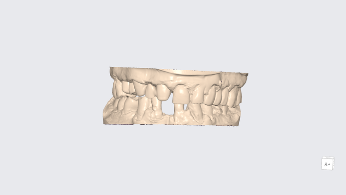 mu quelli 28 protesico dentale t cnico dente modelo modello exocad 3d stl dentista gratuito gratis ortodonzia odontolog impresi n cad muñon ricordare far fronte 3d print model - Mito3D