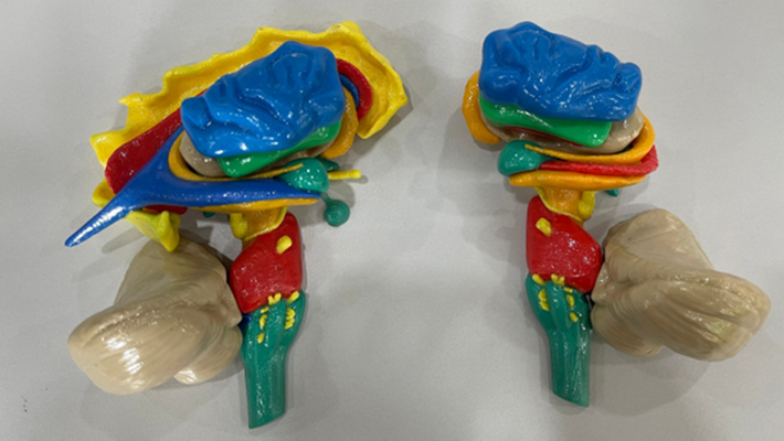 renkli magnetic assembled beyin kök yarım küre baz alınan gangliyon talamus karıncık optik kafatası sinir temel pons hipotalamus orta solgunluk beyincik çekirdek hipokampus anatomi nöroloji 3d print model - Mito3D