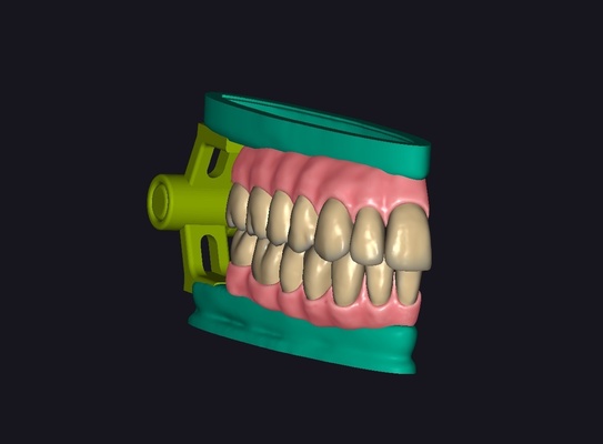 occlusione denti contatto punti dentale dente articolatore 3d print model - Mito3D