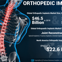 orthopädisch Implantate Markt 3d print model - Mito3D