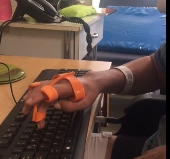orthèse dactylographie écran tactile accessibilité aide technologie d'assistance assistante invalidité main handicap outils professionnel thérapie orthèses prothèse 3d print model - Mito3D