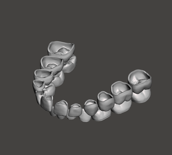 pediatra dentes cartuchos dental bebê primário coroa 3d print model - Mito3D