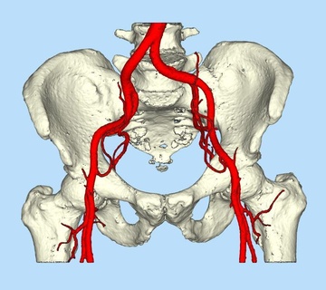 pelvis sangre vasos cadera anatomía 3d impresión hueso 3d print model - Mito3D