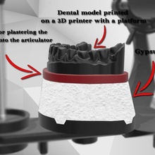 cartón yeso 3d impreso modelos herramienta dental modelo articulador enlucido técnico 3d print model - Mito3D