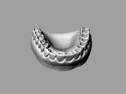 uygulama diş boşluklar hekimliği onarıcı 3d print model - Mito3D