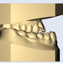 prognathous adj - prognathe divers de modèle dentaire le dentiste dents modèles 3d print model - Mito3D