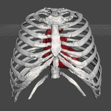 Rippen Käfig Truhe Anatomie Medizin Thorax Box Brust Studie Knochen 3d print model - Mito3D