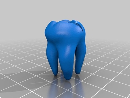 rotten tooth molar mouth teeth 3d print model - Mito3D