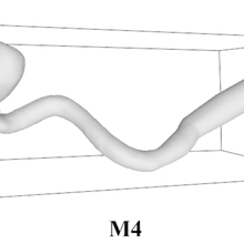 saccular aneurysm m4 tool vessels 3d print model - Mito3D