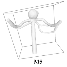 saccular aneurysm m5 tool vessels 3d print model - Mito3D